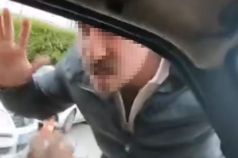 Ailesinin yanında saldırıya uğradı: Olayın faturası 430 bin lira oldu