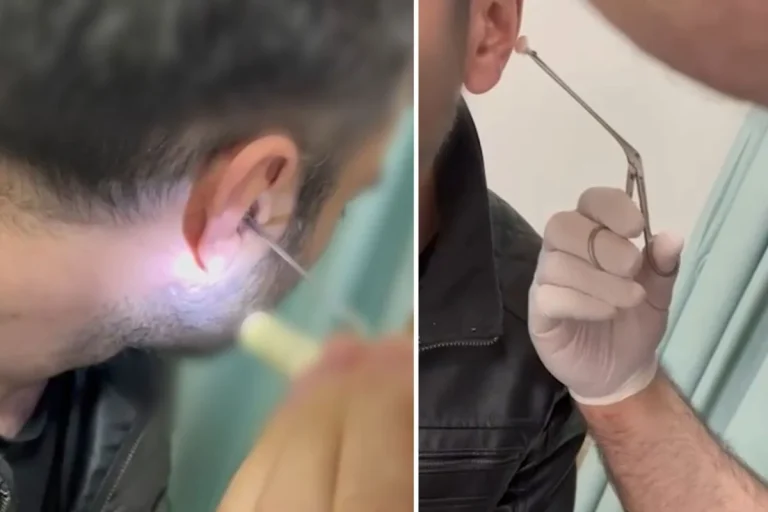 Kulağına gizlediği uyuşturucuyla yakalandı